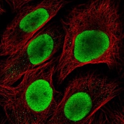 HDGF Antibody, Novus Biologicals:Antibodies:Primary Antibodies